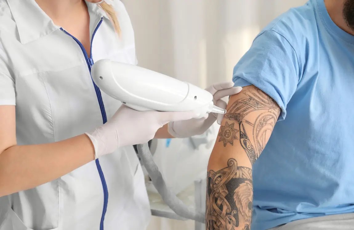 Can You Tattoo Over Eczema? What You Need to Know