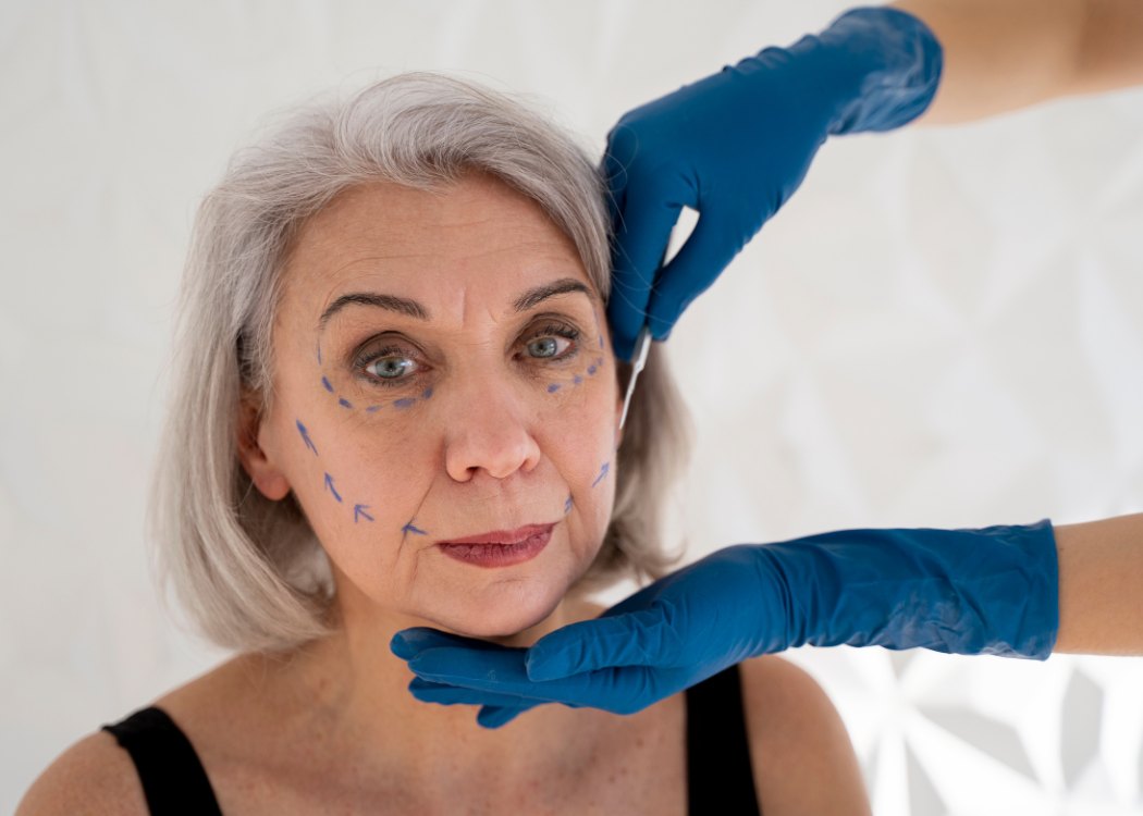 How Long Do Fillers Last?