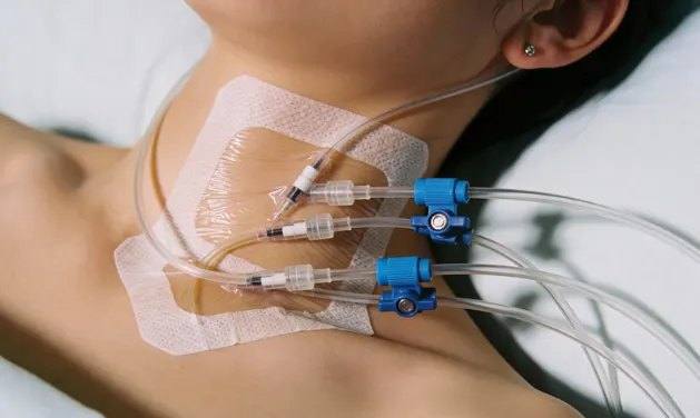 Turkey Neck Treatment: Non-Surgical Options (and When You Need a Surgeon)