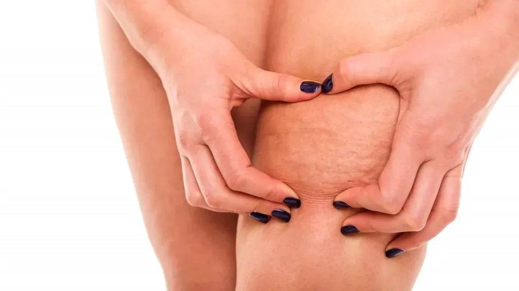 Is cellulitis dangerous to my health?