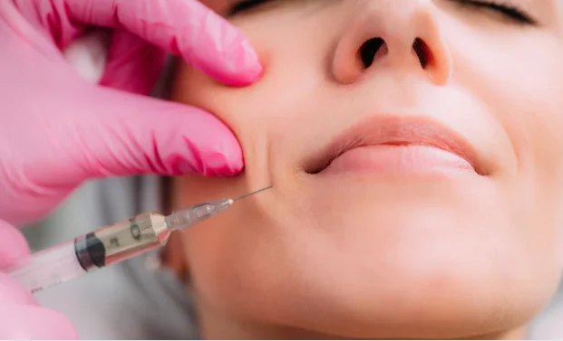 Nasolabial Fold Filler for Smile Lines: Cost, Results, Brooklyn